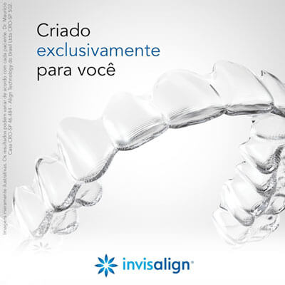 Primeira Consulta Invisalign - Vs Ortodontia - Vivianne Sato